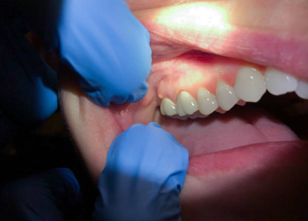 Best Emergency TMJ Treatment in Holly Springs, MS